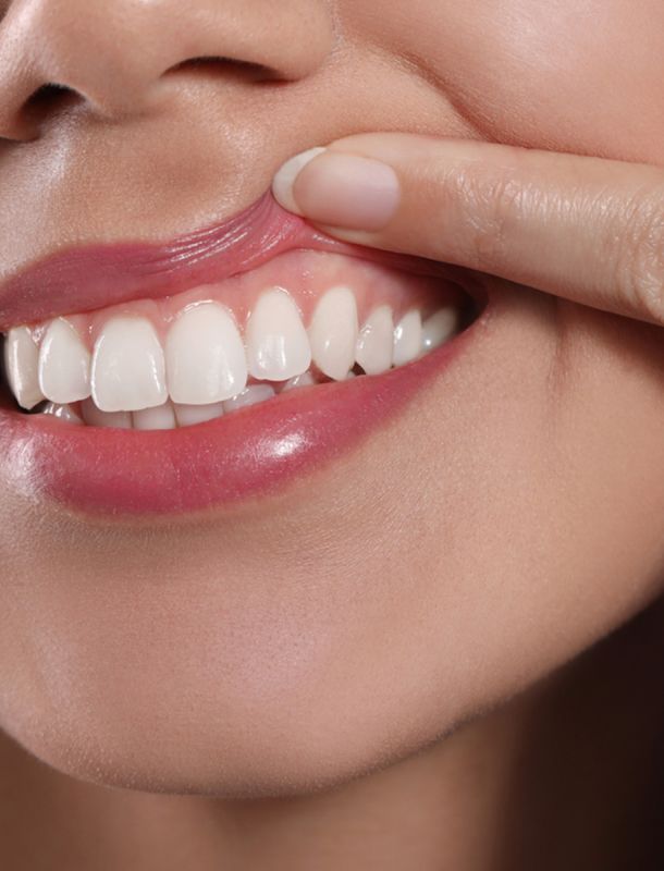 Periodoncia (Salud de Encías)