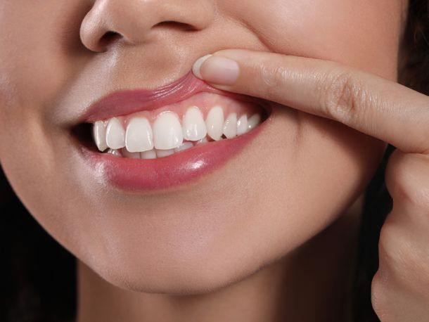 Periodoncia (Salud de Encías)