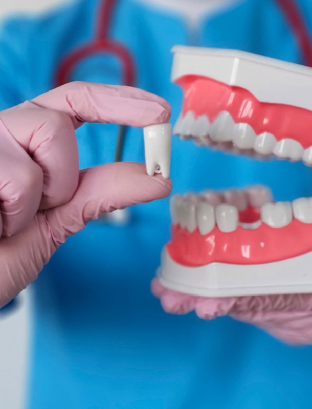 Implantología Dental Avanzada