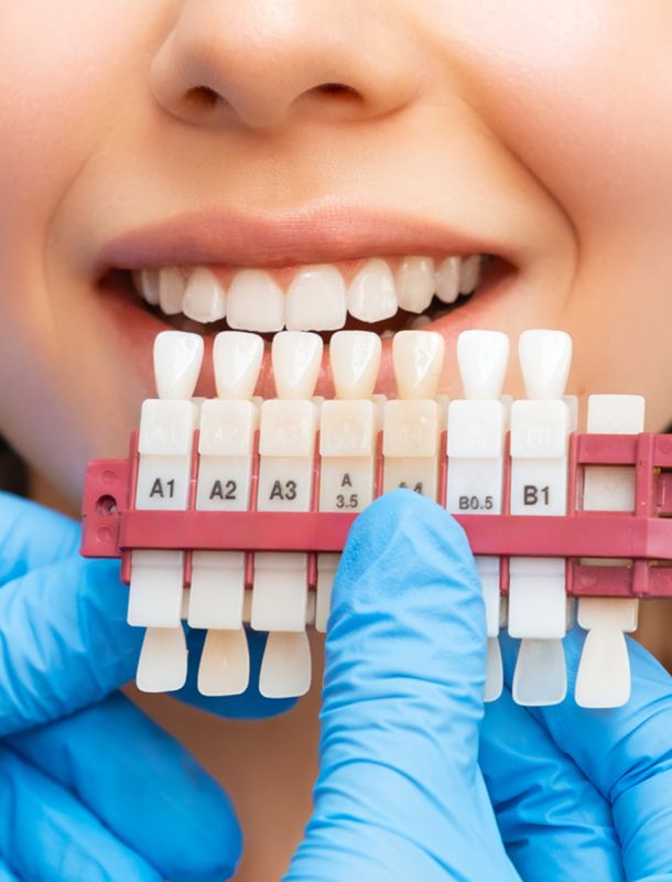 Estética Dental