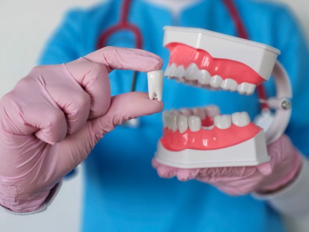 Implantología Dental Avanzada